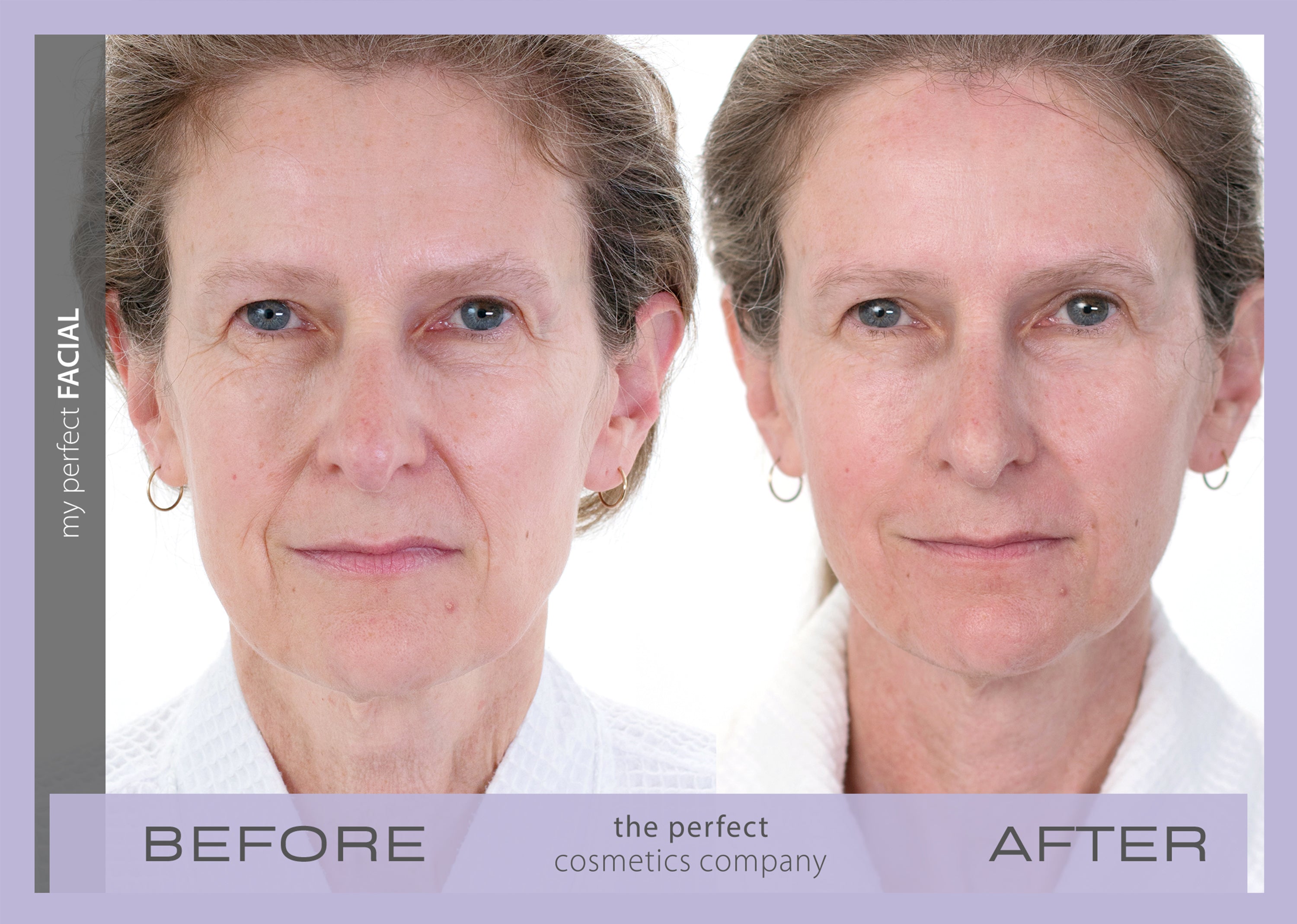 My Perfect Facial results before and after lifting, toning, firming face neck and décolletage for smoother complexion