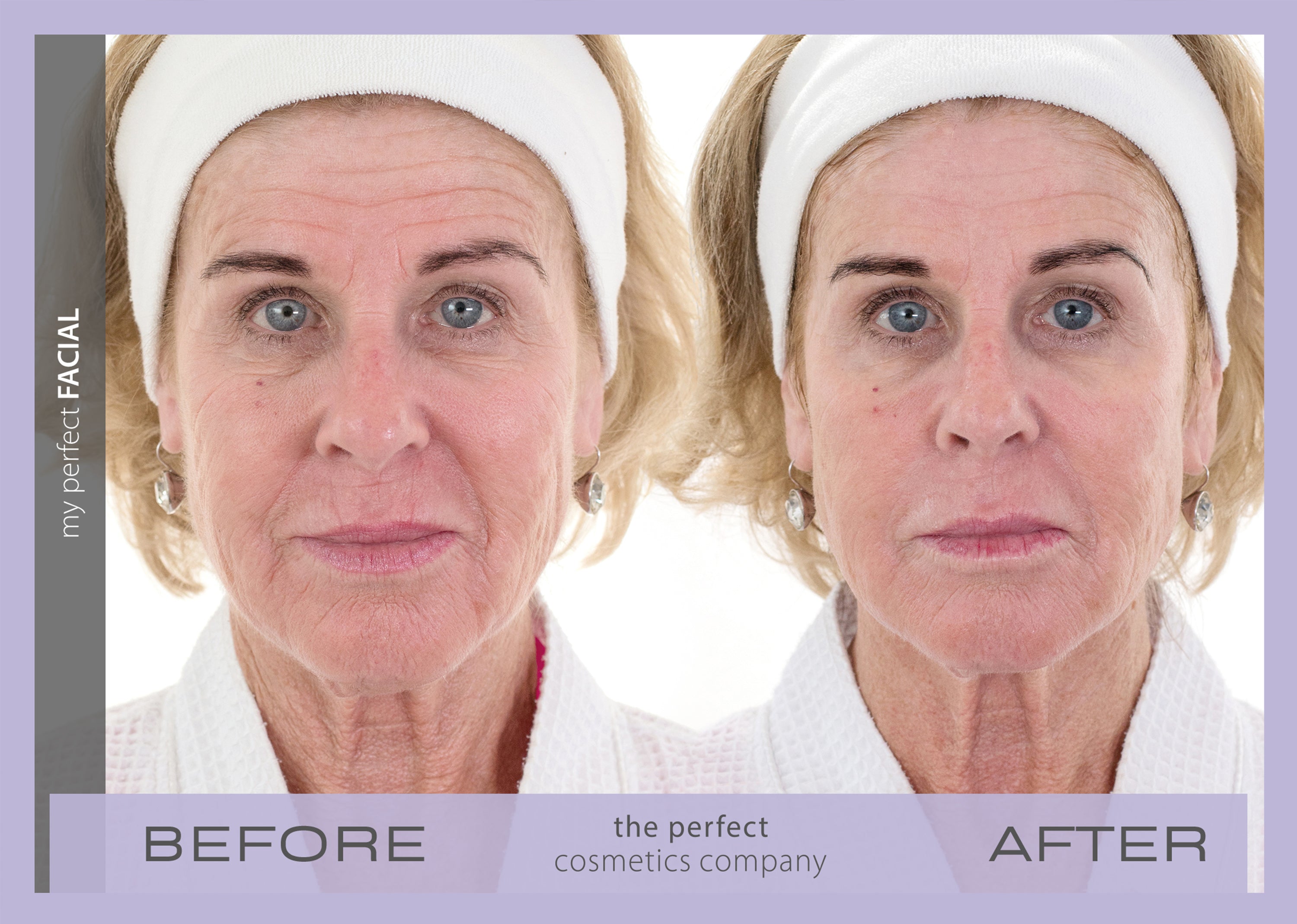 My Perfect Facial before and after results lifting and firming skin, reducing fine lines and wrinkles, improving texture