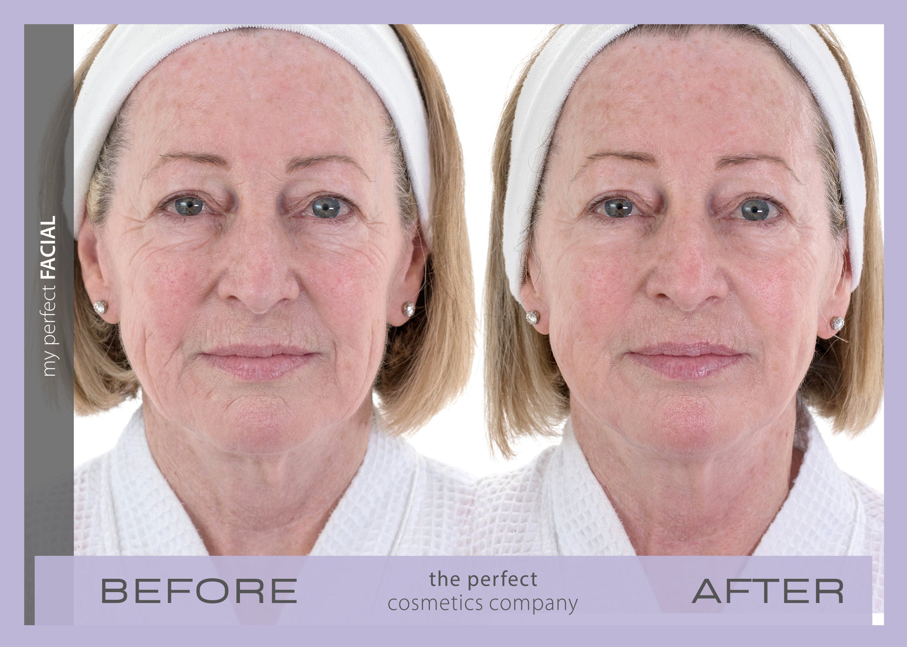 My Perfect Facial before and after results lifting and firming skin, reducing fine lines and wrinkles, improving texture